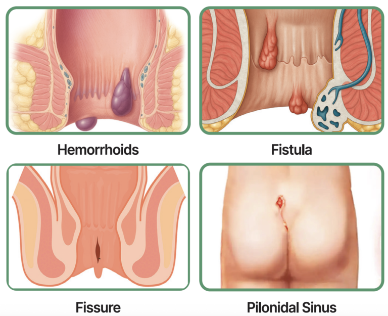 course on proctology